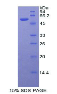 Recombinant Estrogen Receptor Alpha (ERa)