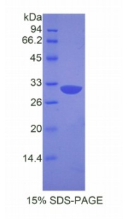 Recombinant Apoptotic Peptidase Activating Factor 1 (APAF1)