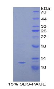 Recombinant Peptide YY (PYY)