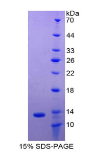 Recombinant Polymeric Immunoglobulin Receptor (PIGR)