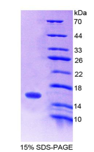 Recombinant Secretin (SCT)