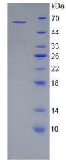 Recombinant Heat Shock 70kDa Protein 1A (HSPA1A)