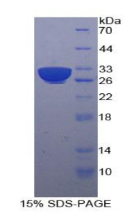 Recombinant Heat Shock 70kDa Protein 9 (HSPA9)