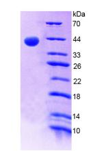 Recombinant Alkaline Phosphatase, Tissue-nonspecific (ALPL)