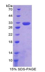 Recombinant Brain Finger Protein (BFP)