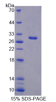 Recombinant Brain Finger Protein (BFP)