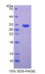 Recombinant Brain Finger Protein (BFP)