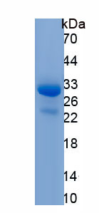 Recombinant Coagulation Factor XIII A1 Polypeptide (F13A1)