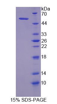 Recombinant Myosin Light Chain Kinase (MYLK)