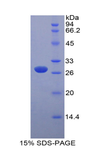 Recombinant Myosin Light Chain Kinase (MYLK)