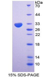 Recombinant Nucleoporin 85 (NUP85)