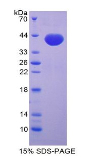 Recombinant Chemokine C-C-Motif Ligand 14 (CCL14)