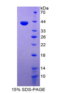 Recombinant Chemokine C-C-Motif Ligand 1 (CCL1)