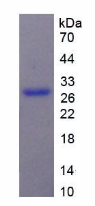 Recombinant Chondroitin Sulfate Proteoglycan 4 (CSPG4)