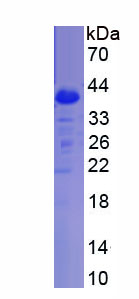 Recombinant Chondroitin Sulfate Proteoglycan 5 (CSPG5)