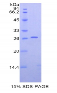 Recombinant Sialic Acid Binding Ig Like Lectin 2 (CD22)