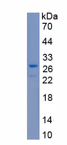 RPB146Hu01.jpg