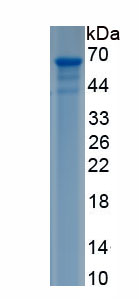 Recombinant Fibrinogen Alpha Chain (FGA)