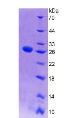 Recombinant Integrin Alpha X (CD11c)