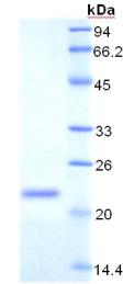 Recombinant Transferrin Receptor (TFR)