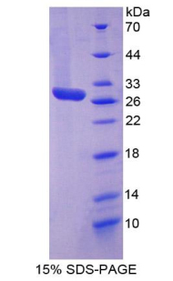 Recombinant Clusterin (CLU)