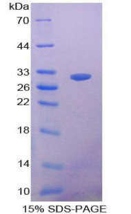 Recombinant Clusterin (CLU)