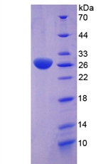 Recombinant Clusterin (CLU)