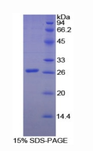 Recombinant Clusterin (CLU)