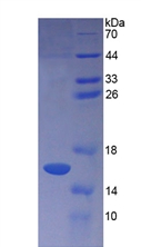 Recombinant Pro-Gastrin Releasing Peptide (ProGRP)