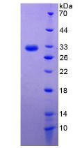 Recombinant Asialoglycoprotein Receptor 1 (ASGR1)