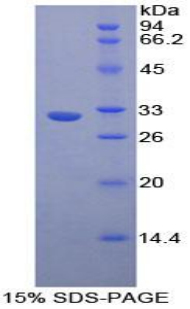 Recombinant Nucleoporin 88 (NUP88)