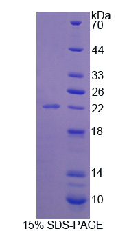 RPB204Hu01.jpg