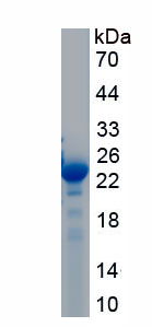 Recombinant Granzyme K (GZMK)