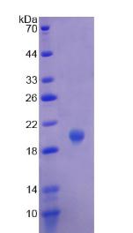 Recombinant Chromogranin A (CHGA)