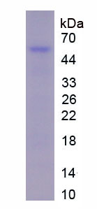 Recombinant Fibrinogen Beta Chain (FGB)