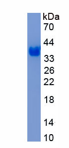 Recombinant Cluster Of Differentiation 56 (CD56)