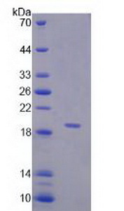 Recombinant Corticosteroid Binding Globulin (CBG)