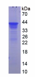 Recombinant Corticosteroid Binding Globulin (CBG)