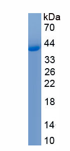 Recombinant Cytokeratin 18 (CK18)