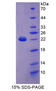 Recombinant Cytokeratin 18 (CK18)