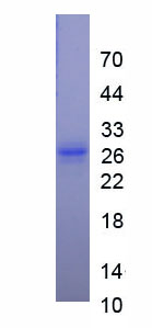 Recombinant Plasminogen (Plg)