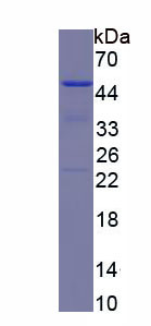 Recombinant Cytokeratin 19 (CK19)