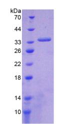 Recombinant ATP Binding Cassette Transporter A1 (ABCA1)