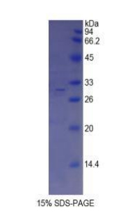 Recombinant ATP Binding Cassette Transporter A1 (ABCA1)