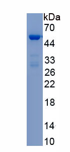 Recombinant Programmed Cell Death Protein 6 Interacting Protein (PDCD6IP)