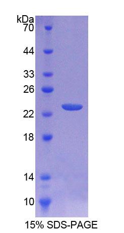 Recombinant Tumor Necrosis Factor Receptor Superfamily, Member 5 (CD40)