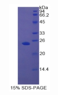 Recombinant Androgen Receptor (AR)