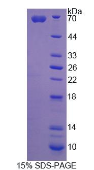 Recombinant Angiostatin (ANG)