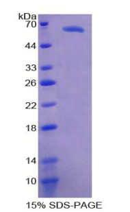 Recombinant Scavenger Receptor Class D Member 1 (SCARD1)