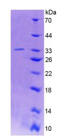 Recombinant Glutamate Decarboxylase 2 (GAD2)